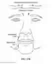 Fig. 144 - Pixel array medical systems, devices and methods