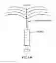 Fig. 151 - Pixel array medical systems, devices and methods
