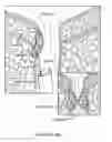 Fig. 168 - Pixel array medical systems, devices and methods