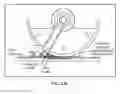 Fig. 19 - Pixel array medical systems, devices and methods