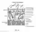 Fig. 35 - Pixel array medical systems, devices and methods