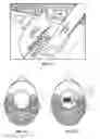 Fig. 40 - Pixel array medical systems, devices and methods