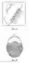 Fig. 41 - Pixel array medical systems, devices and methods