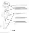 Fig. 61 - Pixel array medical systems, devices and methods