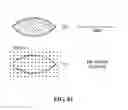 Fig. 83 - Pixel array medical systems, devices and methods
