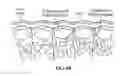 Fig. 88 - Pixel array medical systems, devices and methods