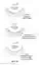 Fig. 93 - Pixel array medical systems, devices and methods
