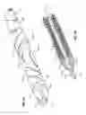 Fig. 04 - Device and method for centering and crossing a vascular occlusion