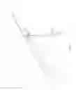 Fig. 09 - Vascular access configuration