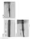 Fig. 36 - Flow and delivery apparatus