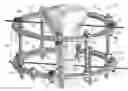 Fig. 01 - BONE FIXATOR APPARATUS