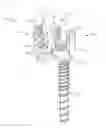 Fig. 01 - Spinal implant system and method