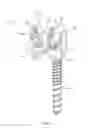 Fig. 05 - Spinal implant system and method