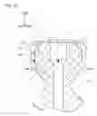 Fig. 11 - Spinal implant