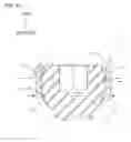 Fig. 23 - Spinal implant