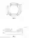 Fig. 04 - Orthopedic fixation devices and methods of installation thereof