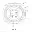 Fig. 11 - Orthopedic fixation devices and methods of installation thereof
