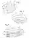 Fig. 02 - Medical implant receivers having dual lead in closure mating thread forms