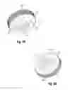 Fig. 13 - Interspinous spacers and associated methods of use and manufacture