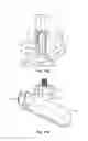 Fig. 17 - Interspinous spacers and associated methods of use and manufacture
