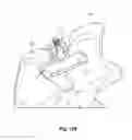 Fig. 19 - Interspinous spacers and associated methods of use and manufacture