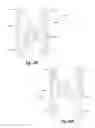 Fig. 49 - Interspinous spacers and associated methods of use and manufacture