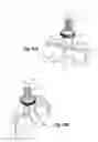 Fig. 70 - Interspinous spacers and associated methods of use and manufacture