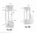 Fig. 85 - Interspinous spacers and associated methods of use and manufacture