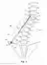Fig. 02 - Device and method for treatment of spinal deformity