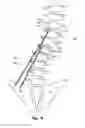 Fig. 05 - Device and method for treatment of spinal deformity