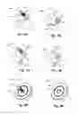 Fig. 07 - Device and method for treatment of spinal deformity