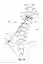 Fig. 13 - Device and method for treatment of spinal deformity