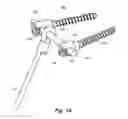 Fig. 14 - Device and method for treatment of spinal deformity