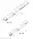 Fig. 15 - Device and method for treatment of spinal deformity