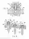 Fig. 03 - ORTHOPEDIC ANCHOR ASSEMBLY
