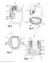 Fig. 03 - Polyaxial bone anchoring device with enlarged pivot angle