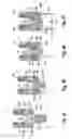 Fig. 08 - Polyaxial bone anchoring device with enlarged pivot angle