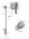 Fig. 03 - Reduction tool
