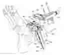 Fig. 01 - Ankle replacement system and method