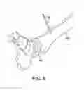 Fig. 08 - Ankle replacement system and method