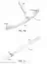 Fig. 11 - Ankle replacement system and method