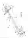 Fig. 12 - Ankle replacement system and method