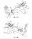 Fig. 13 - Ankle replacement system and method