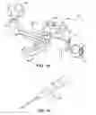 Fig. 17 - Ankle replacement system and method