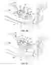 Fig. 22 - Ankle replacement system and method