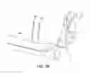 Fig. 23 - Ankle replacement system and method