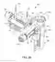 Fig. 24 - Ankle replacement system and method