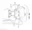 Fig. 33 - Ankle replacement system and method
