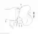 Fig. 34 - Ankle replacement system and method