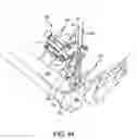 Fig. 41 - Ankle replacement system and method